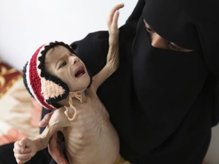 الأمم المتحدة تطلق تحذير طارئ بشأن الأزمة الإنسانية في «اليمن»