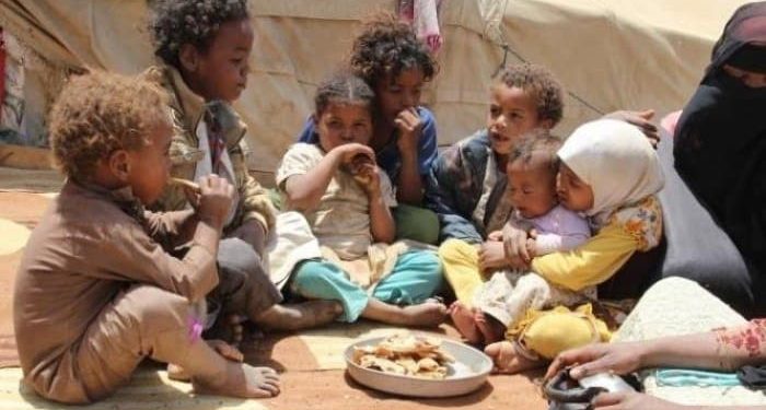 طاعون الجرع الحوثية ينهش ما تبقى من أجساد اليمنيين في مناطق سيطرة الميليشيات