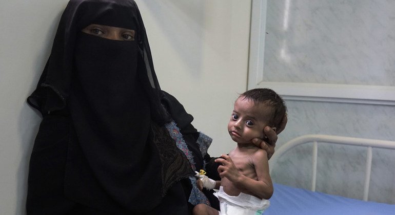 بينها اليمن.. تقرير أممي 750 ألف شخص يواجهون المجاعةَ والموتَ في خمس دول