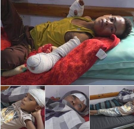 رابطة حقوقية: مليشيات الحوثي تسببت في مقتل واصابة اكثر من 14 الف طفلاً في اليمن