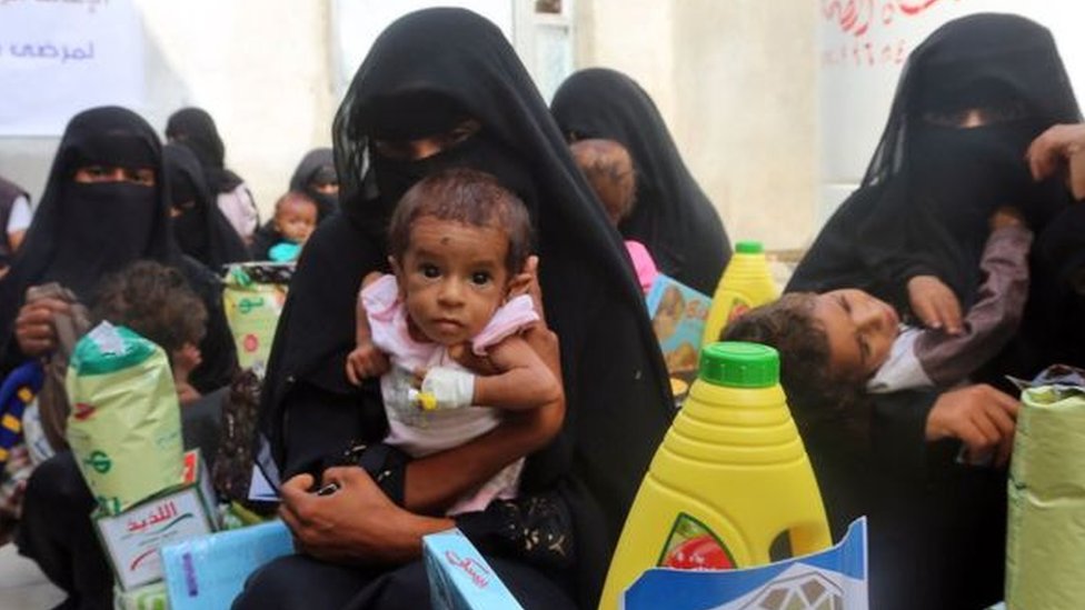شبكة دولية تقرع جرس الإنذار: 60بالمائة من اليمنيين سيعانون من انعدام الأمن الغذائي الحاد