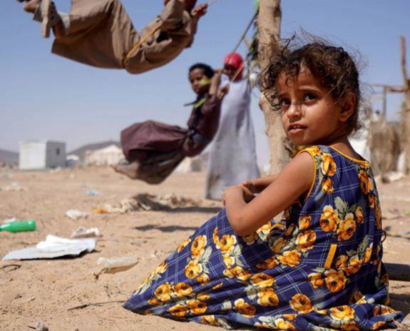 أوكسفام: 17 مليون يمني يعانون في الوقت الحالي من الجوع وخطر الإصابة بسوء التغذية الحاد