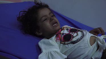 طبيب في صنعاء يحذر: ''مرض قد يتحول الى وباء يشبه كورونا يفتك بالأطفال''