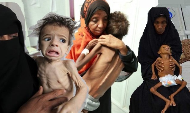 بيان أممي يقرع ناقوس خطر المجاعة في اليمن :80 في المائة من اليمنيين لا يستطيعون توفير الطعام