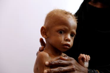 اليونيسف تكشف عن  خطوة واحدة تفصل 6 ملايين طفل باليمن عن المجاعة