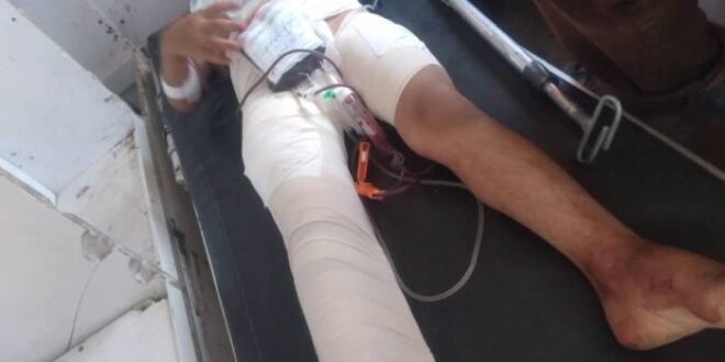 إصابة طفلة برصاص قناص حوثي بمديرية قعطبة شمالي الضالع
