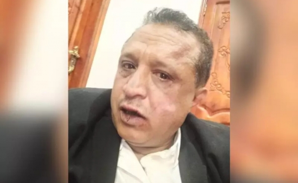 شاهد تعليق لنقابة الصحفيين اليمنيين بشأن حادثة الاعتداء الحوثي على الصحفي "الصمدي "