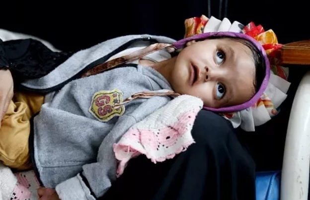 اشتباه بجريمة حوثية تجاه أطفال مرضى في صنعاء