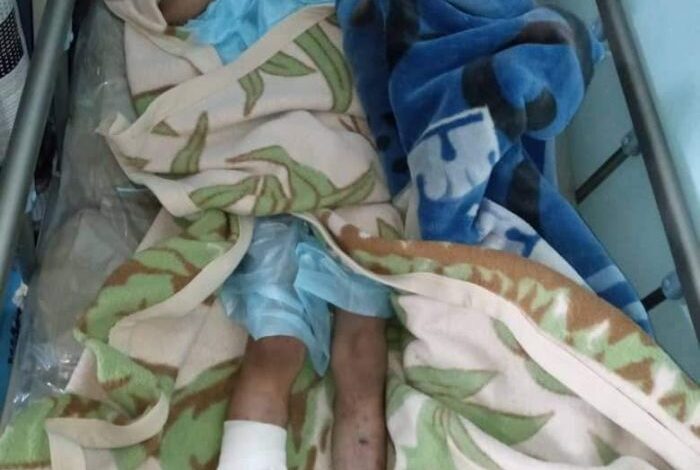 القضاء الحوثي يتسبب بمقتل أب ونجله في ريمة