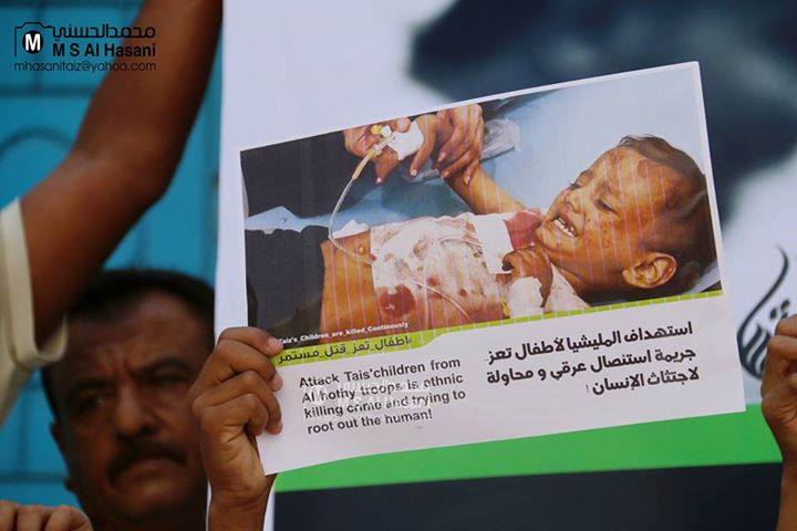 طفولة اليمن تحترق.. «اليونيسيف» تصدم العالم بأرقام مروعة